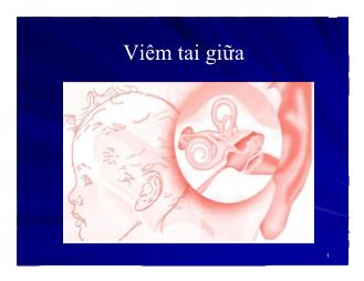 Bài giảng Viêm tai giữa