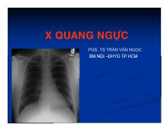 Bài giảng X - Quang ngực