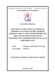 Research on treatment of proximal arterial occlusion of the anterior cerebral circulation system within the first 6 hours with intravenous thrombolytic combined with mechanical thrombectomy