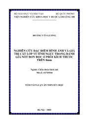 Tóm tắt Luận án Nghiên cứu đặc điểm hình ảnh và giá trị cắt lớp vi tính ngực trong đánh giá nốt đơn độc ở phổi kích thước trên 8mm