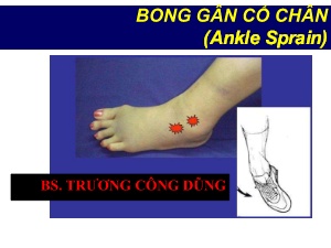 Bài giảng Bong gân cổ chân