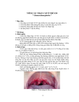 Bài giảng Viêm cầu thận cấp ở trẻ em